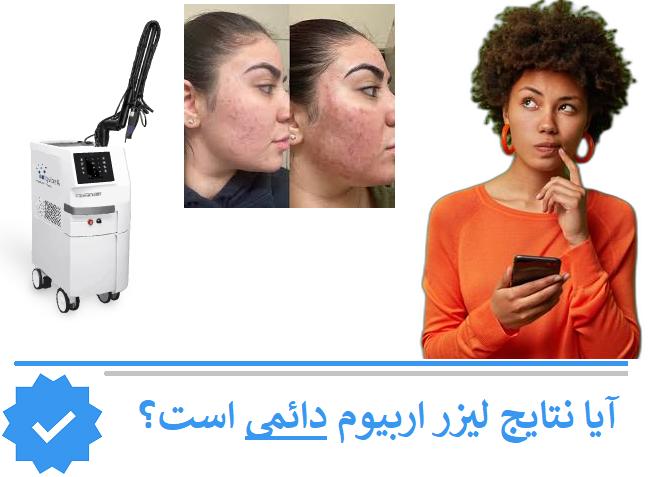 آیا نتایج لیزر اربیوم دائمی است؟
