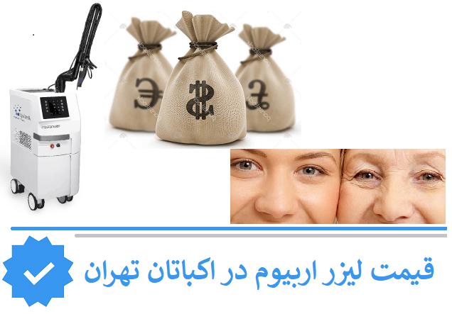 قیمت لیزر اربیوم در اکباتان تهران