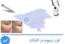 لیزر اربیوم اکباتان
