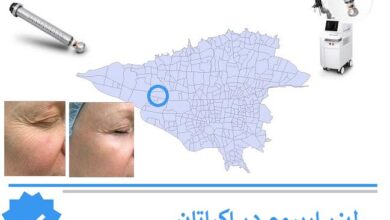 لیزر اربیوم اکباتان