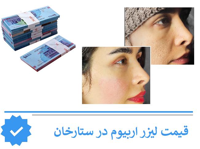 قیمت لیزر اربیوم در ستارخان