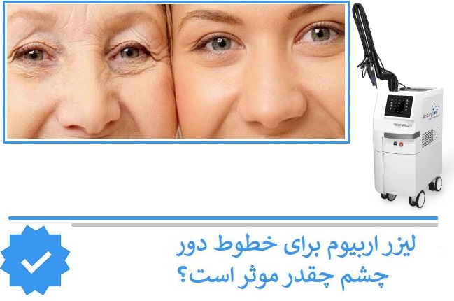 لیزر اربیوم برای خطوط دور چشم چقدر موثر است؟
