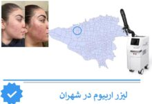 لیزر اربیوم شهران