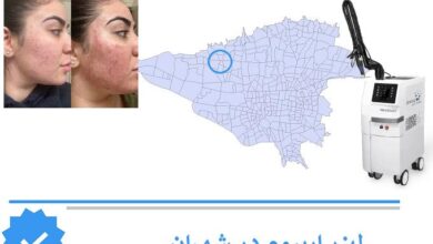 لیزر اربیوم شهران