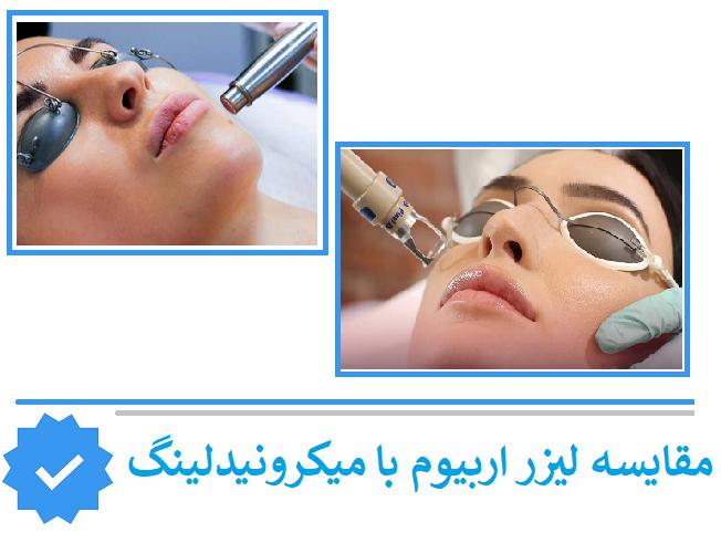 مقایسه لیزر اربیوم با میکرونیدلینگ