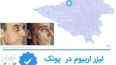 لیزر اربیوم پونک