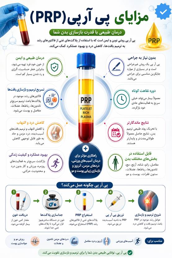 مزایای پی ار پی در پاسداران