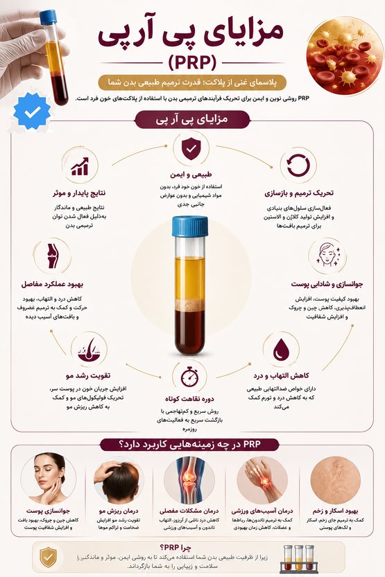 مزایای پی ار پی