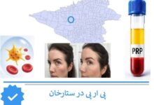 پی ار پی در ستارحان