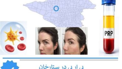 پی ار پی در ستارحان