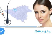 ریزش مو و پی ار پی در شهران