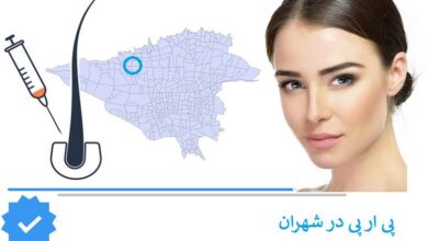 ریزش مو و پی ار پی در شهران