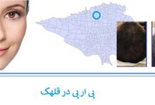 پی ار پی در قلهک