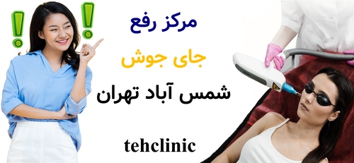 مرکز رفع جای جوش شمس آباد تهران
