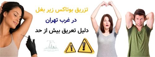 تزریق بوتاکس زیر بغل در غرب تهران + دلیل تعریق بیش از حد
