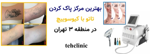 بهترین مرکز پاک کردن تاتو با کیوسوییچ در منطقه ۳ تهران
