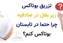 تزریق بوتاکس زیر بغل در صادقیه : چرا حتما در تابستان بوتاکس کنم ؟