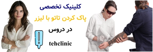 کلینیک تخصصی پاک کردن تاتو با لیزر در دروس