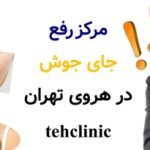 مرکز رفع جای جوش در هروی تهران