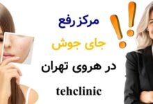 مرکز رفع جای جوش در هروی تهران