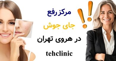 مرکز رفع جای جوش در هروی تهران