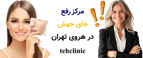 مرکز رفع جای جوش در هروی تهران