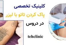 کلینیک تخصصی پاک کردن تاتو با لیزر در دروس