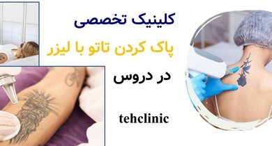 کلینیک تخصصی پاک کردن تاتو با لیزر در دروس