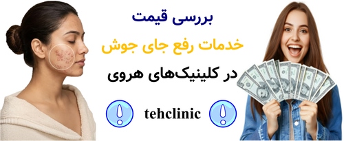 بررسی قیمت خدمات رفع جای جوش در کلینیکهای هروی