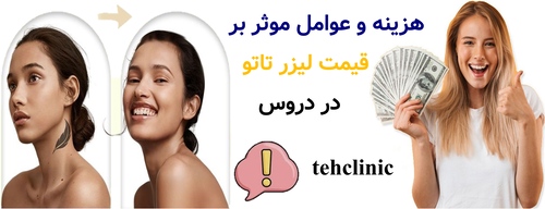 هزینه و عوامل موثر بر قیمت لیزر تاتو در دروس