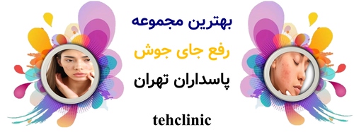 بهترین مجموعه رفع جای جوش پاسداران تهران