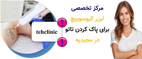 مرکز تخصصی لیزر کیوسوییچ برای پاک کردن تاتو در مجیدیه
