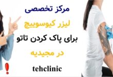 مرکز تخصصی لیزر کیوسوییچ برای پاک کردن تاتو در مجیدیه