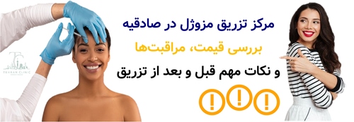 تزریق مزوژل در صادقیه؛ بررسی قیمت، مراقبت‌ها و انتخاب مرکز