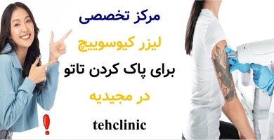 مرکز تخصصی لیزر کیوسوییچ برای پاک کردن تاتو در مجیدیه