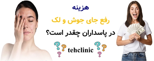 هزینه رفع جای جوش و لک در پاسداران چقدر است؟