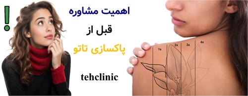 اهمیت مشاوره قبل از پاکسازی تاتو