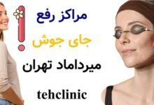 مراکز رفع جای جوش میرداماد تهران