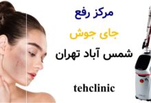 مرکز رفع جای جوش شمس آباد تهران