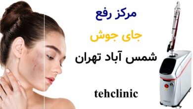 مرکز رفع جای جوش شمس آباد تهران