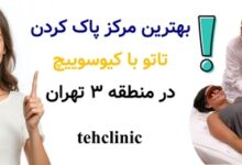 بهترین مرکز پاک کردن تاتو با کیوسوییچ در منطقه ۳ تهران