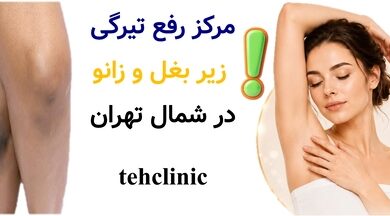 مرکز رفع تیرگی زیر بغل و زانو در شمال تهران