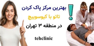 بهترین مرکز پاک کردن تاتو با کیوسوییچ در منطقه ۳ تهران