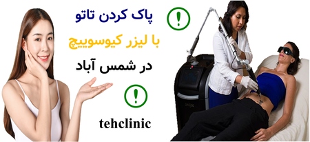 پاک کردن تاتو با لیزر کیوسوییچ در شمس آباد