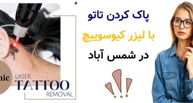 پاک کردن تاتو با لیزر کیوسوییچ در شمس آباد