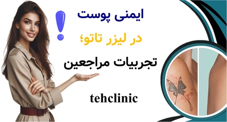 ایمنی پوست در لیزر تاتو؛ تجربیات مراجعین