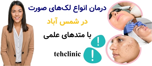 درمان انواع لک‌های صورت در شمس آباد با متدهای علمی