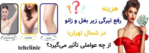 هزینه رفع تیرگی زیر بغل و زانو در شمال تهران؛ از چه عواملی تأثیر می‌گیرد؟