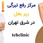 مرکز رفع تیرگی زیر بغل در شرق تهران