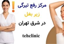 مرکز رفع تیرگی زیر بغل در شرق تهران